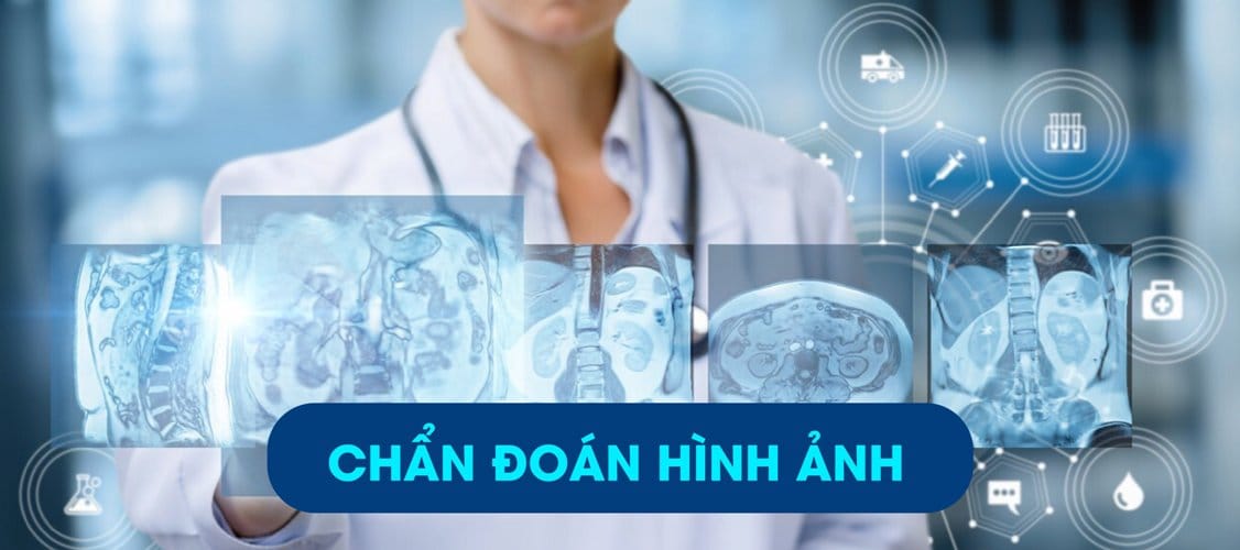 Cao đẳng Chẩn đoán Hình ảnh